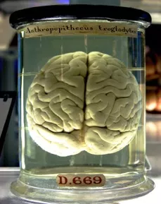 Preserved brain in a jar