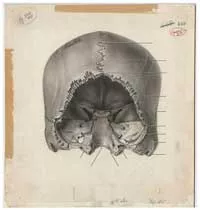  Chubb's illustration of a skull for the atlas (courtesy of U of T biomedical communications)