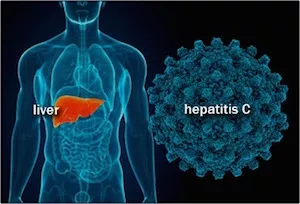 human body diagram with liver and hepatitis C