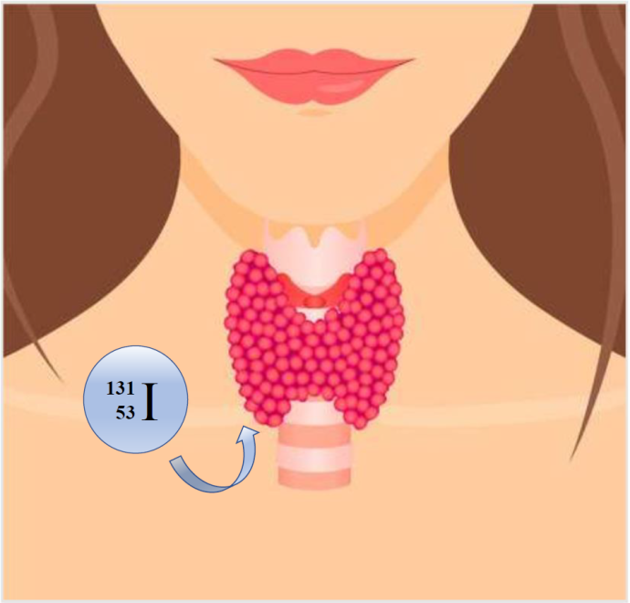 An image of radioidone being direct toward a woman's thyroid gland. Image adapted from 123RF.com.