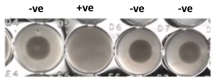 Four round dishes, three with a button-like dark spot in the middle and a fourth that looks grey