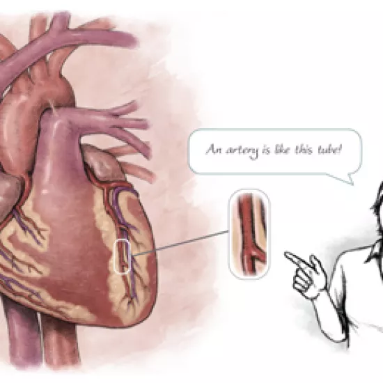 Illustration comparing heart artery to tube